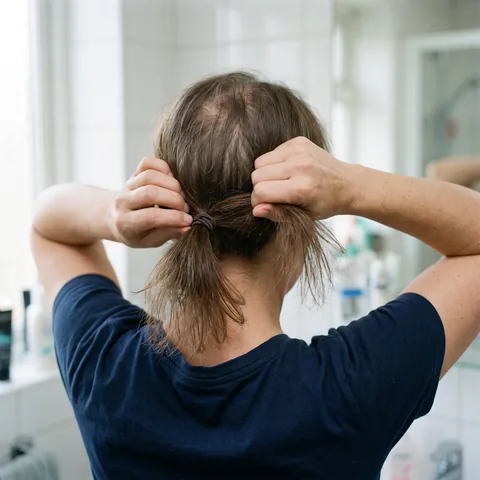 A thin ponytail, thinning all over