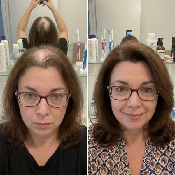 Before and after the at-home hair remedy