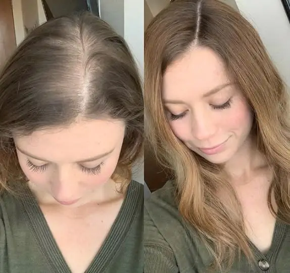 Before and after the at-home hair remedy