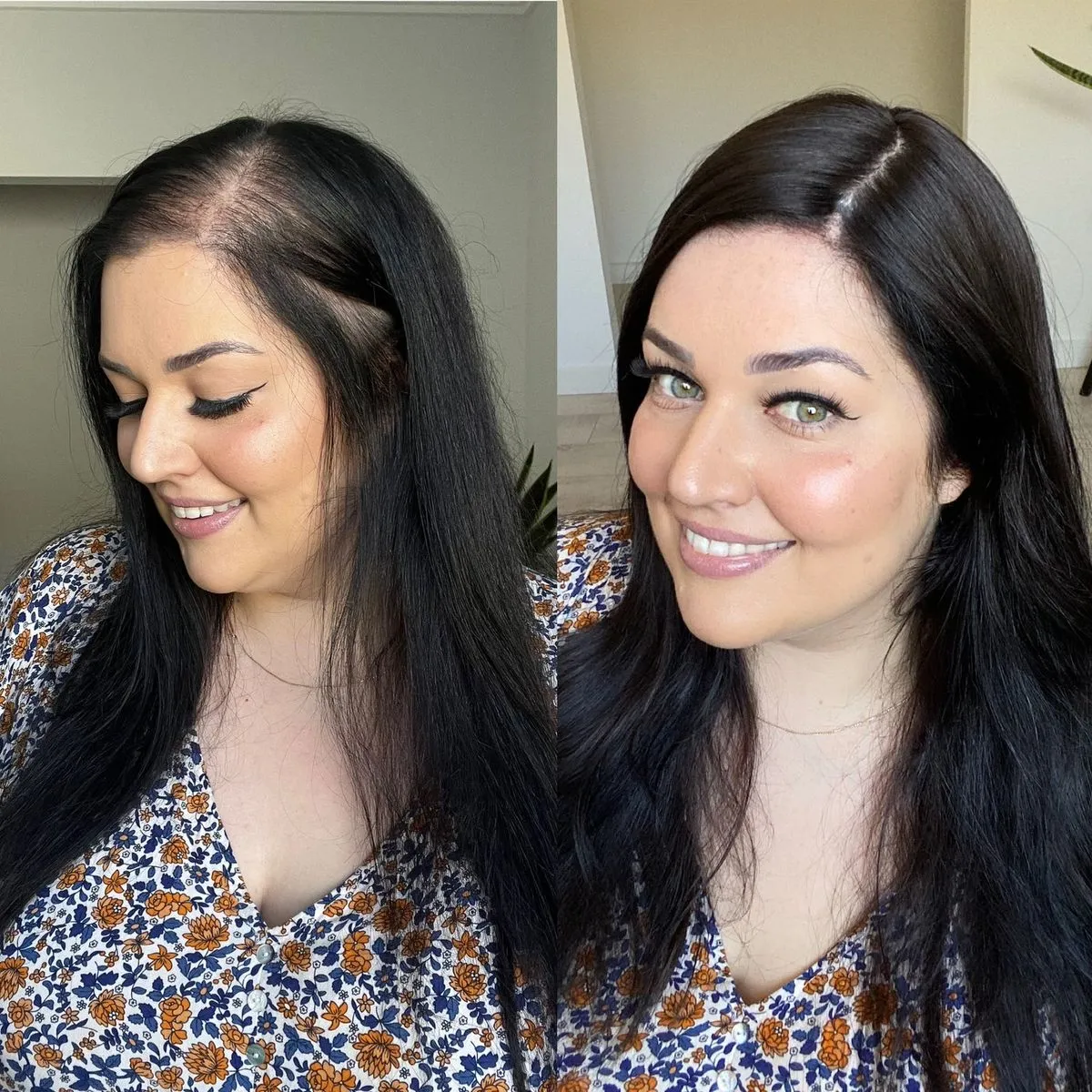 Before and after the at-home hair remedy