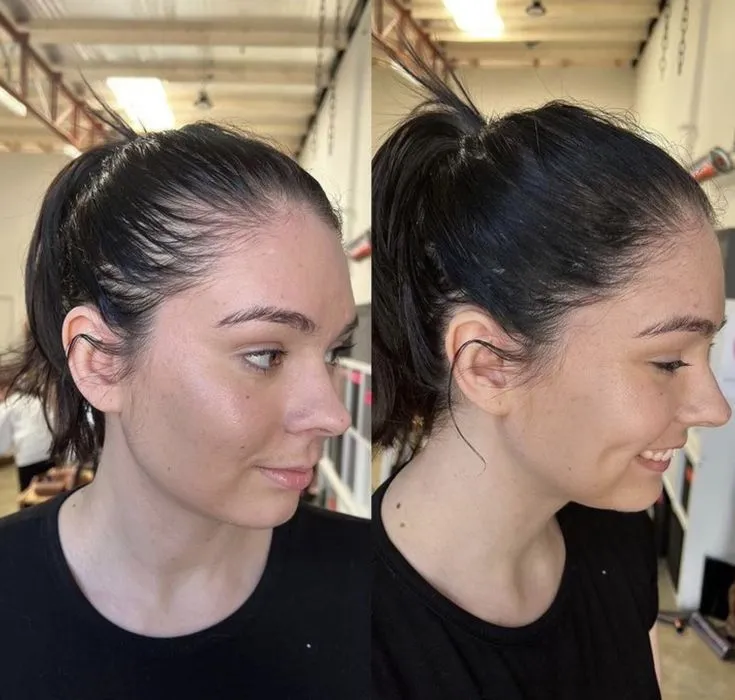 Before and after the at-home hair remedy