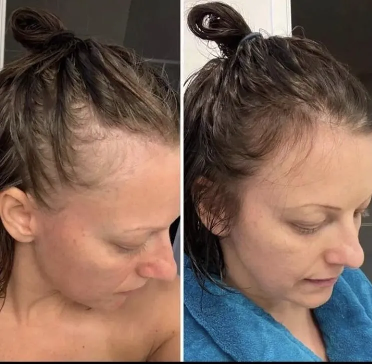 Before and after the at-home hair remedy