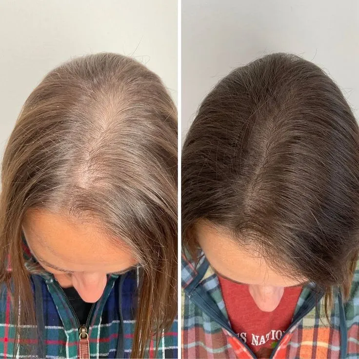 Before and after the at-home hair remedy