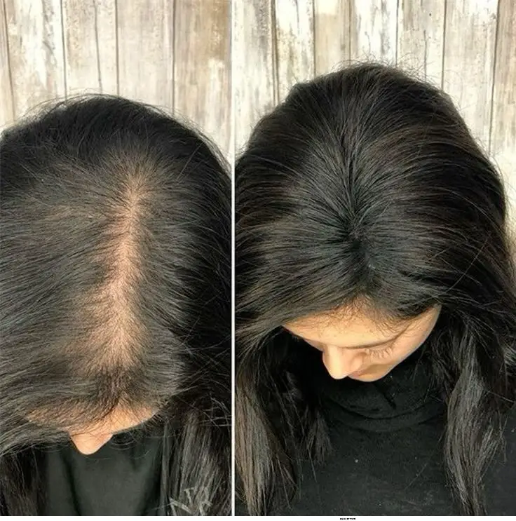 Before and after the at-home hair remedy